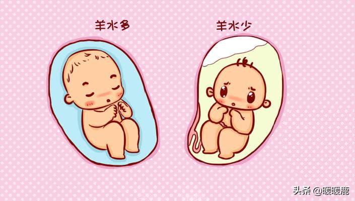 羊水过多的原因分析,羊水浑浊的原因和解决方法