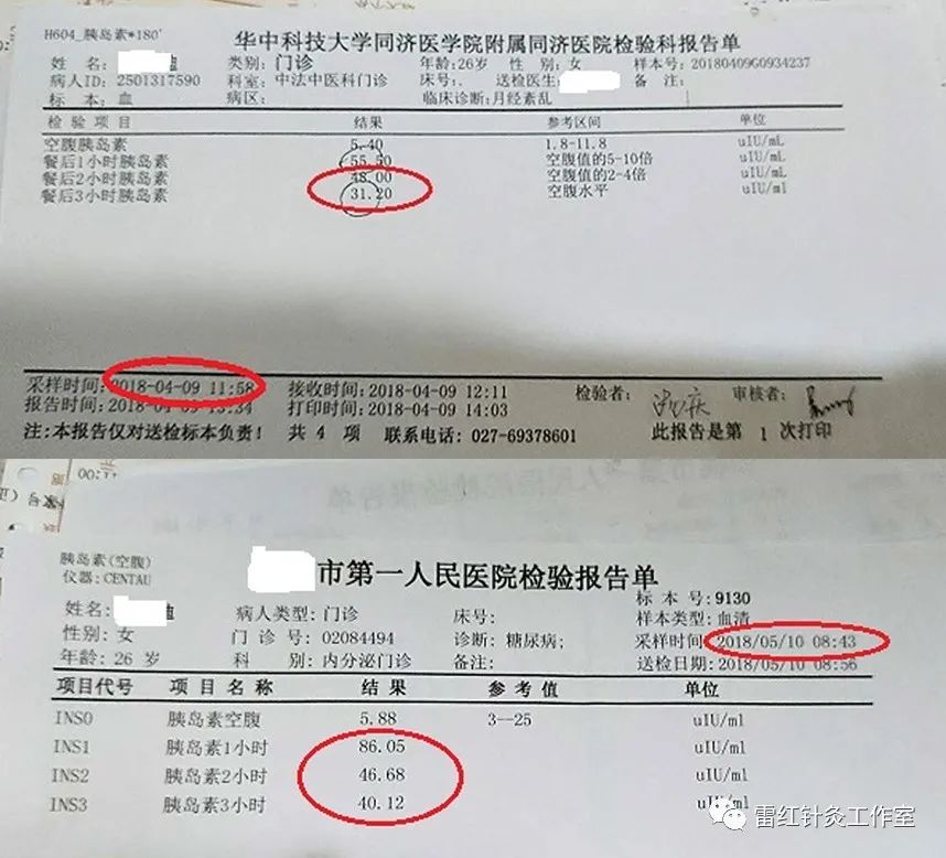 多囊卵巢综合征患者能自然怀孕吗？