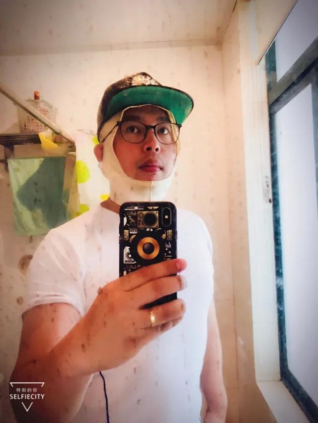 抽脂亲身经历回忆,抽脂血泪史