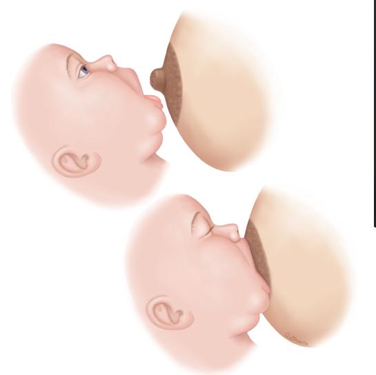 母乳喂养成功的措施有哪些,坚持母乳喂养让宝宝更健康更聪明