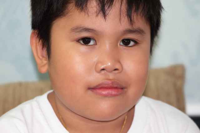 孩子脖子黑是糖尿病么,糖尿病颈部发黑怎么回事