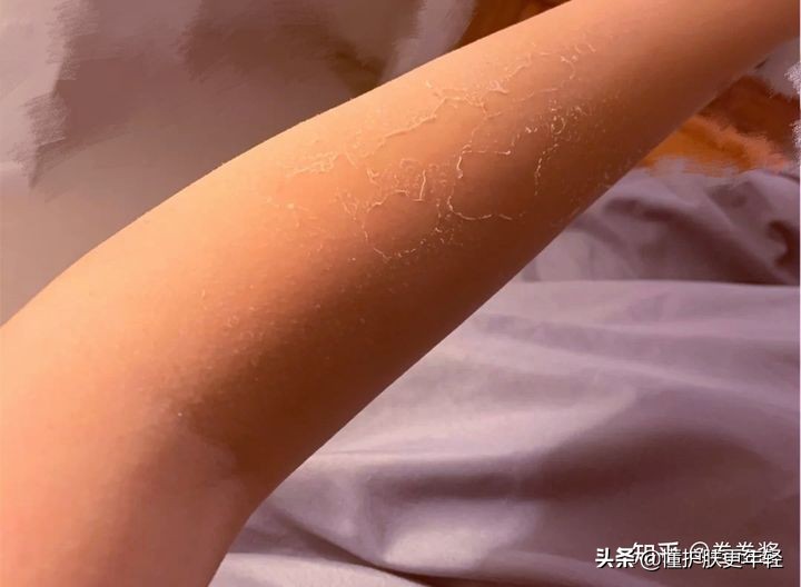 见效最快的美白护肤品有副作用吗,见效很快的美白产品能用吗