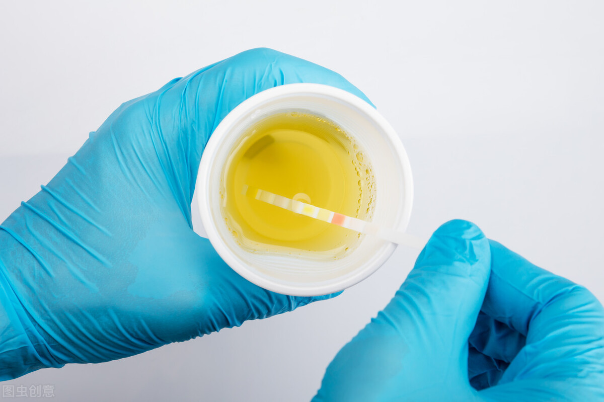 尿常规大部分人都做错了，想要准确的检测结果就要选择这样留尿