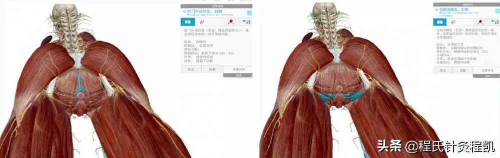 医师分享：什么是盆底肌，它在哪里？