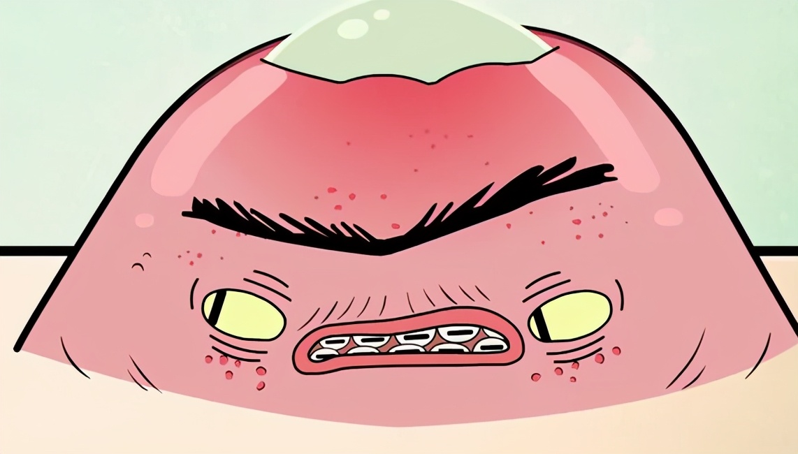 下颚痘痘反反复复是什么原因,下颌线上的痘痘反反复复怎么治