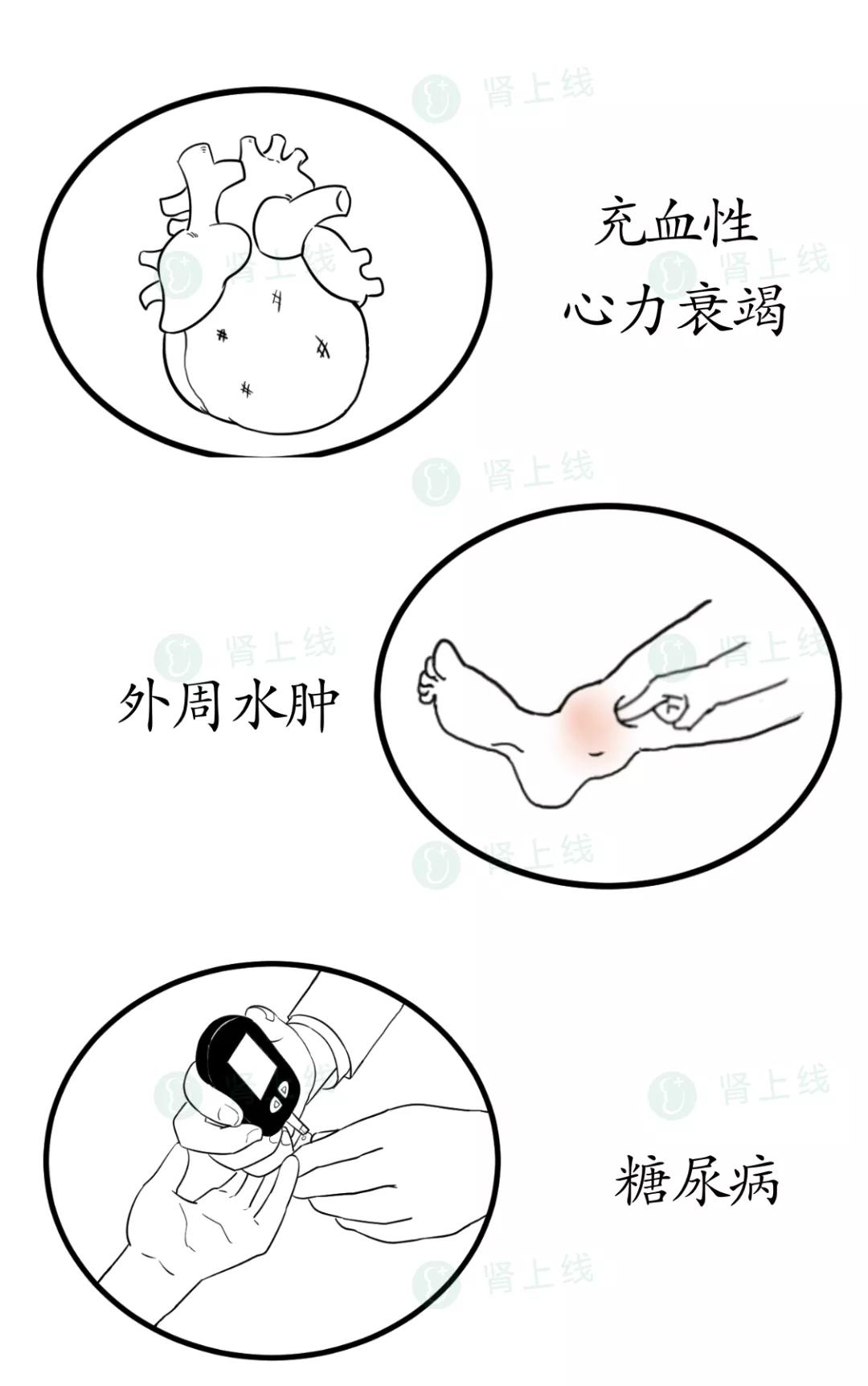 夜尿多是肾虚还是肾气不固,夜尿多不是尿频是什么原因