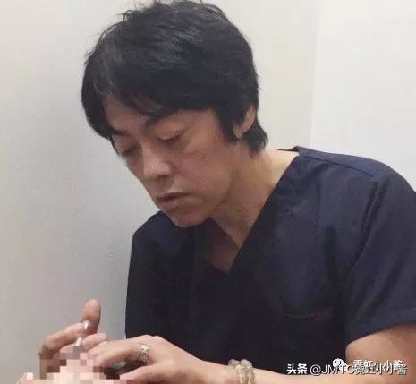 日本小姐姐针灸瘦脸视频,小姐姐打瘦脸针视频