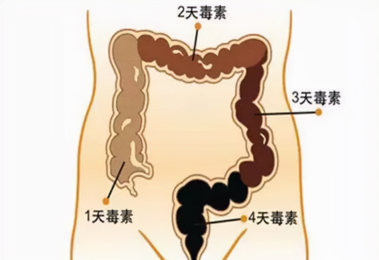 人体内真有6公斤宿便吗？怎么才能排出那些“赖着不走”的宿便？