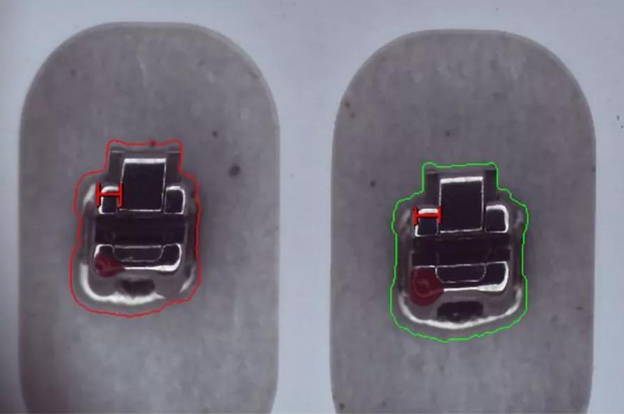 机器视觉边缘检测一般用什么算法,机器视觉目标识别和定位算法