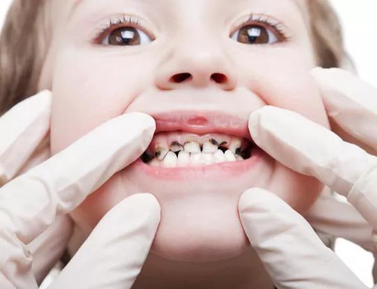 乳牙反正都要换,乳牙反正要换掉没必要天天刷吧