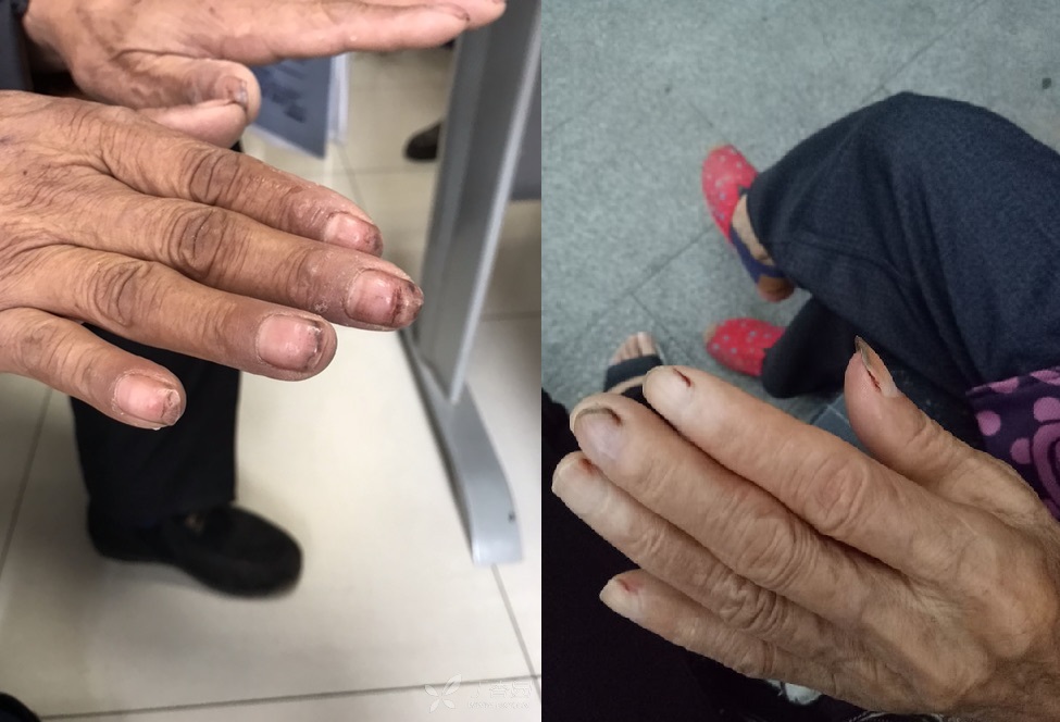 老人剪指甲用的剪刀,老人指甲剪带放大镜