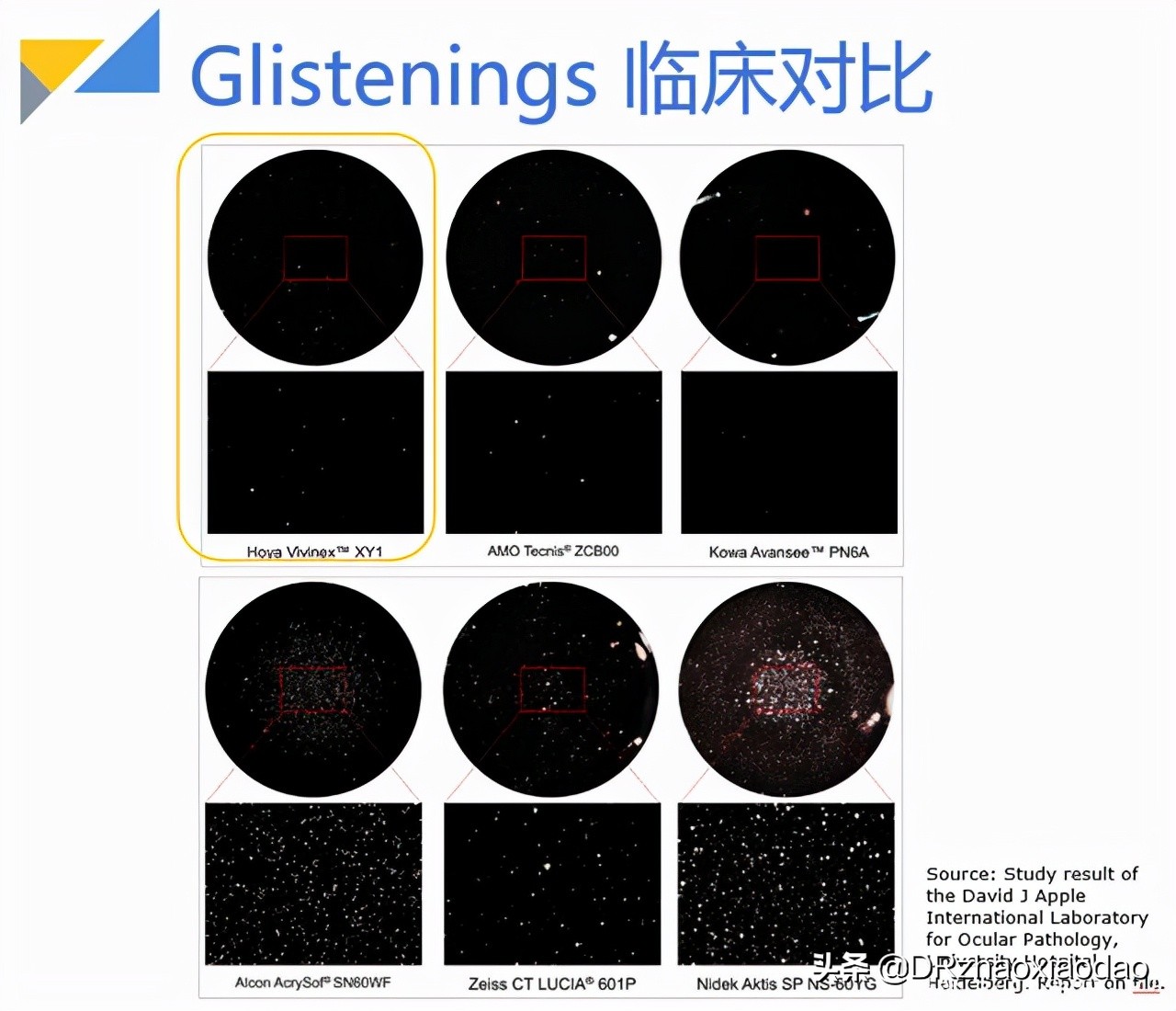 白内障手术人工晶体选择,白内障手术人工晶体是怎么做的