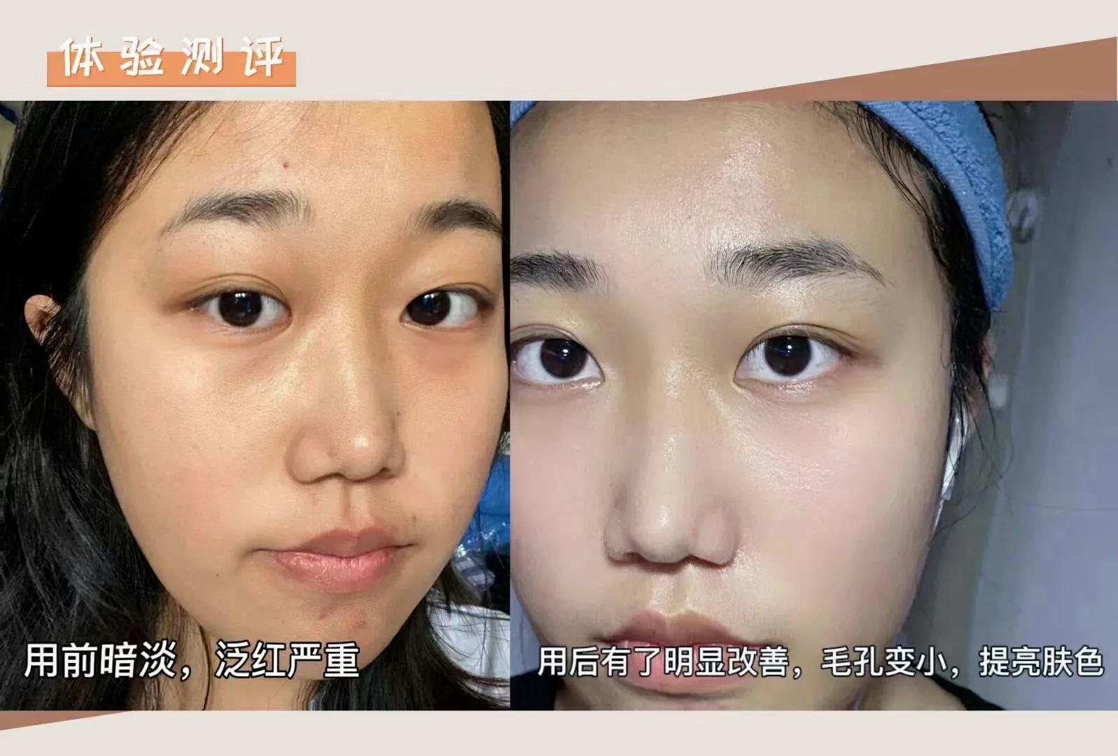 夏季干皮补水哪个牌子好,40岁混干皮夏季适合什么护肤品