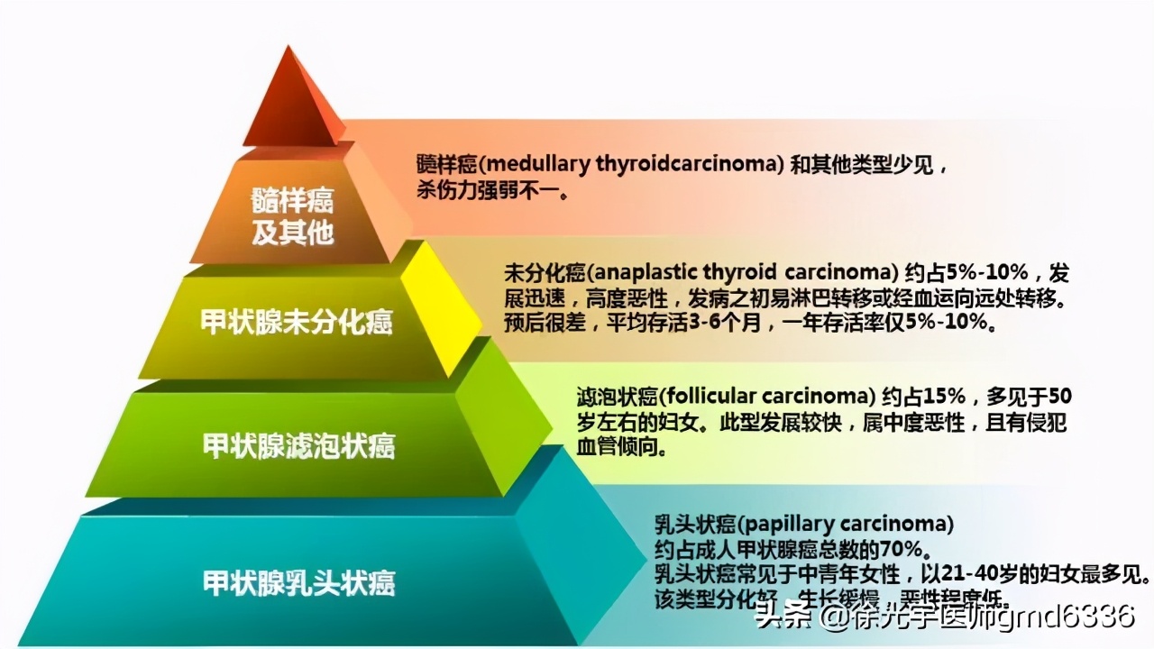 被从业者玩坏的甲状腺癌，它的各种传说都在这儿