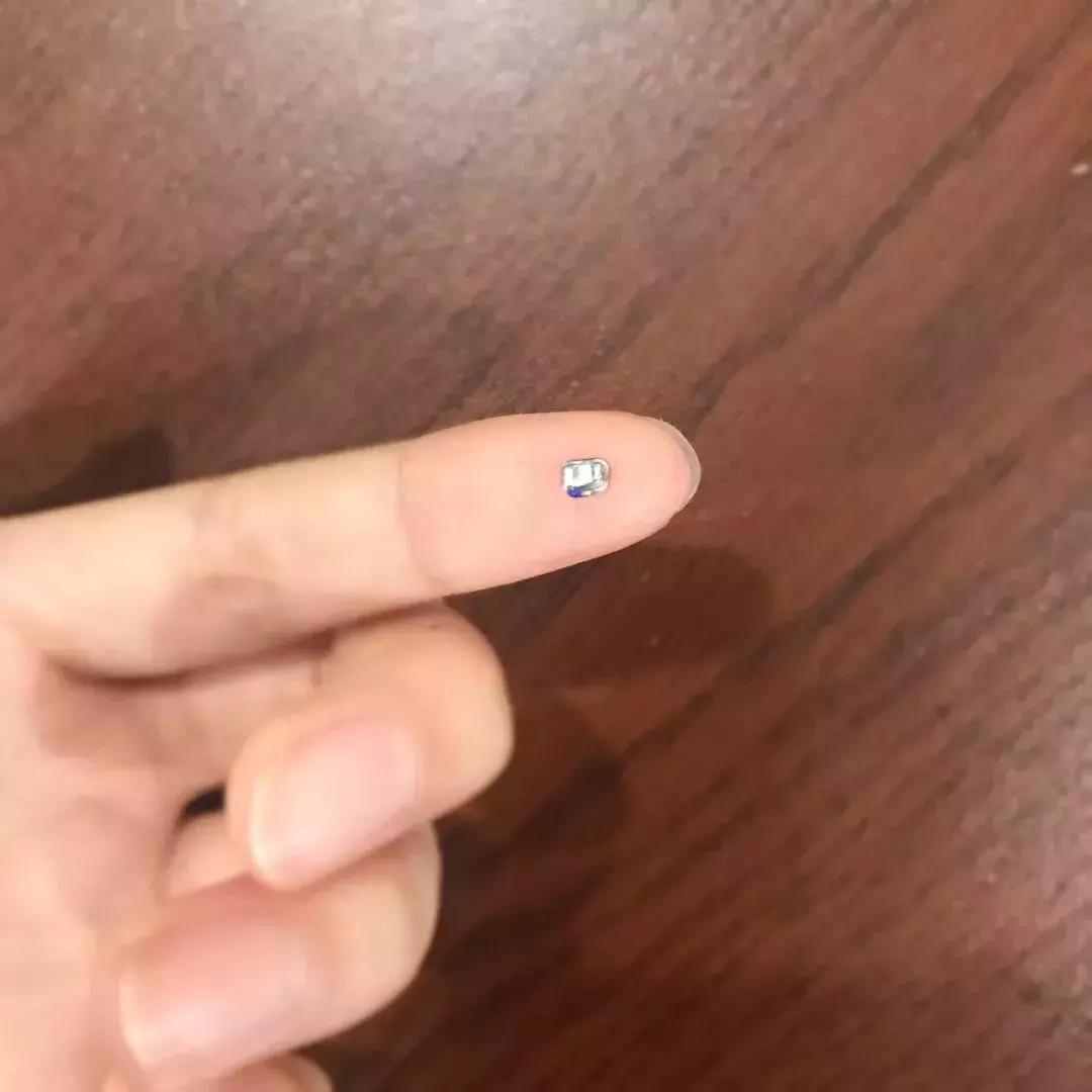戴一个牙套牙会黑吗,戴个牙套有什么用处