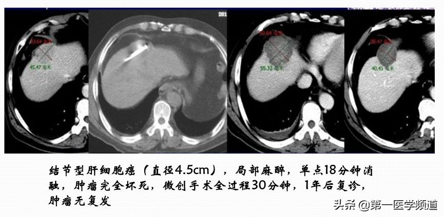 「医影传声」上海交通大学医学院附属瑞金医院卢湾分院放射科主任