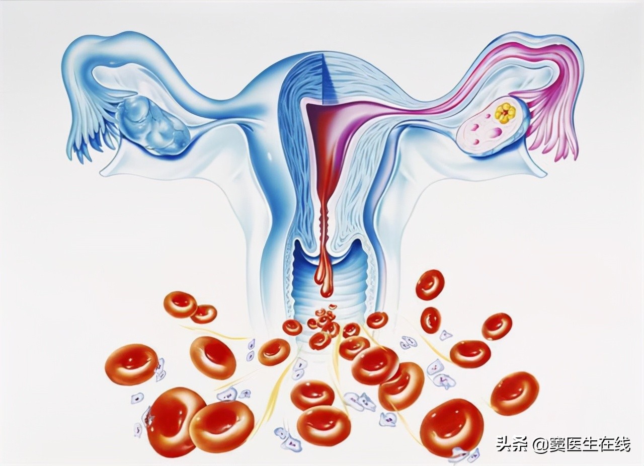 子宫腺肌症痛经最简单的止痛方法,子宫腺肌症痛经是腹部什么部位疼