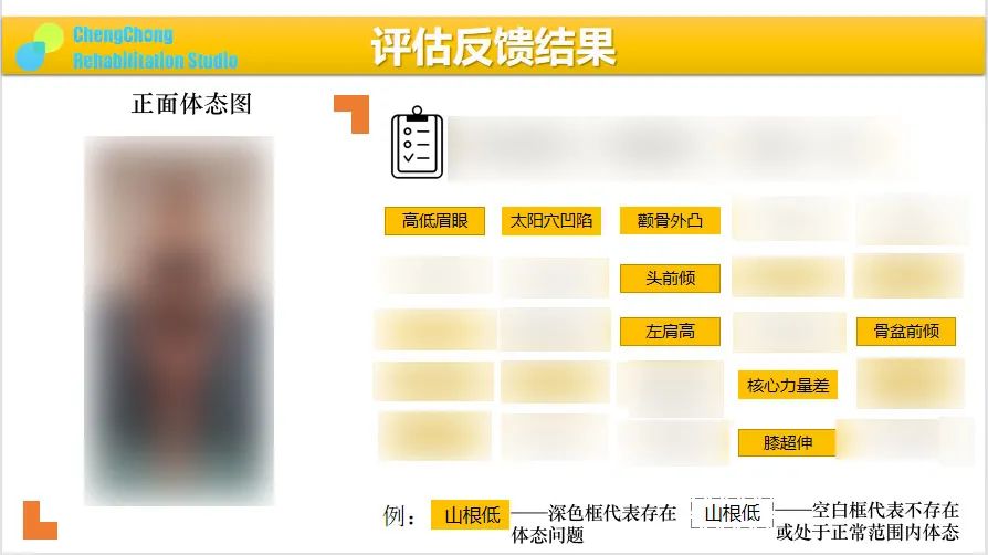 教你一招解决高低眉的小技巧,哪个动作可以改善高低眉