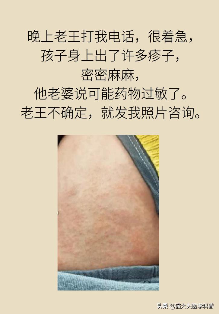 8个月婴儿发烧最快退烧方法,幼儿急疹高烧如何退热