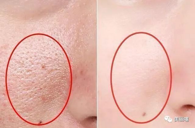 超级好用国内维生素e乳液,药店买的维生素e可以祛斑吗