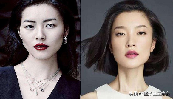 高颧骨下颌宽,颧骨高低颌骨宽上镜怎么办