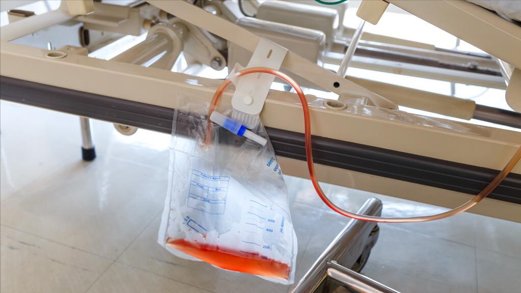 导致尿黄的各种原因,解小便感到小便烫是什么原因