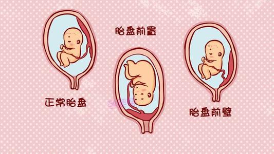 胎盘低怎么养胎,后壁胎盘出现了胎盘低置怎么办