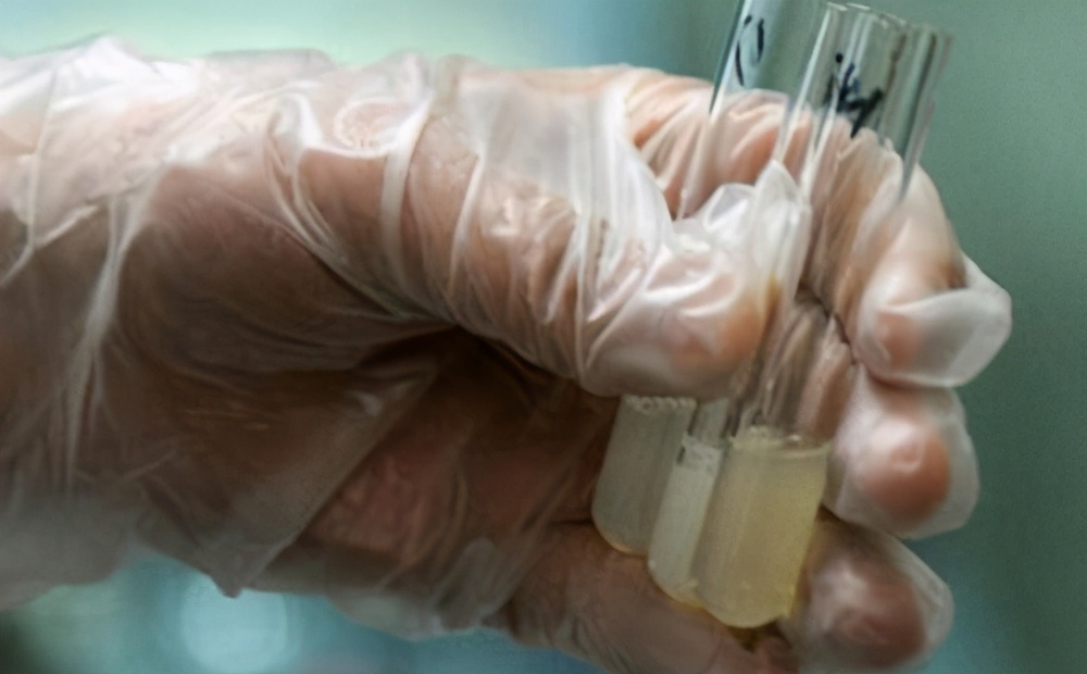 你的精液健康吗？精液品质自我检测四招？