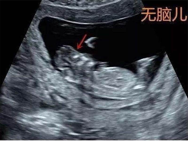 备孕期怎样可以快速怀上宝宝,备孕期怎样才能快速怀上小孩