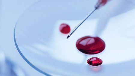 低温治疗的持续时间,低温疗法降温要求