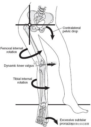 体态矫正膝盖超伸,八岁孩子膝超伸怎么锻炼矫正
