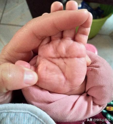新生宝宝是断掌，奶奶说是富贵的象征，医生的话让妈妈悔恨不已