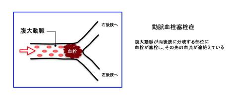 猫忽然后肢瘫痪,猫右后脚突然跛行原因