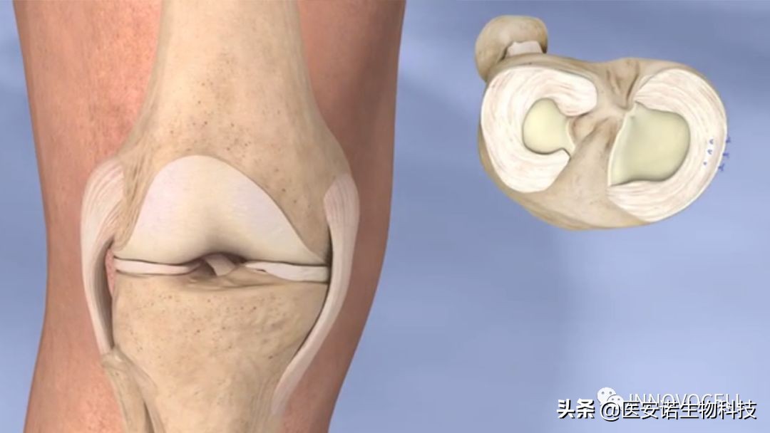 医安诺：4小时，让受损关节重回巅峰