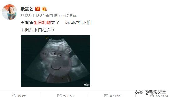 张歆艺孕期牙疼,张歆艺孕晚期