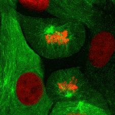 生物实验使用显微镜怎么用双眼看,生物显微镜人眼看到的图像