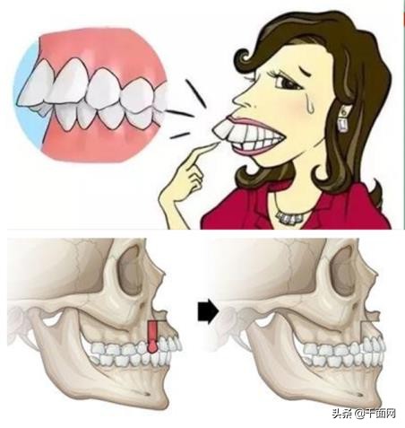 美人三分龅为什么不好看,美人三分龅十瘪九美什么意思