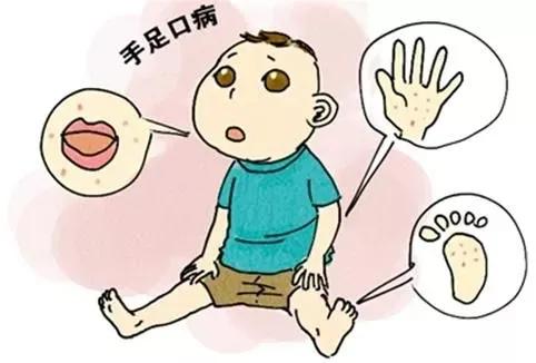 手足口病的预防与护理温馨提示,幼儿手足口病预防知识