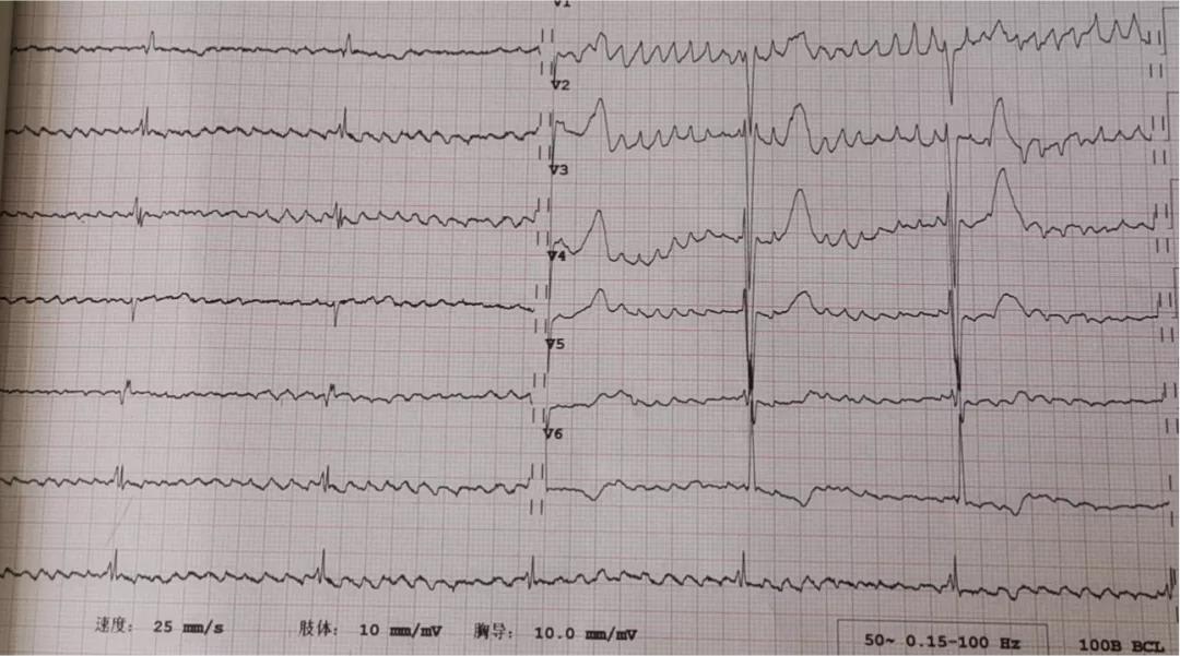 患者的治疗方案？患者的选择或是医生的选择，如何选择最优解？