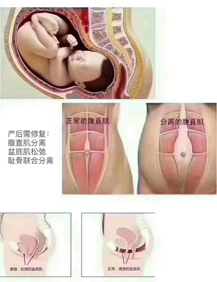 瑜伽解剖系列之腹直肌，产后修复、腰部赘肉、痛经相关肌肉