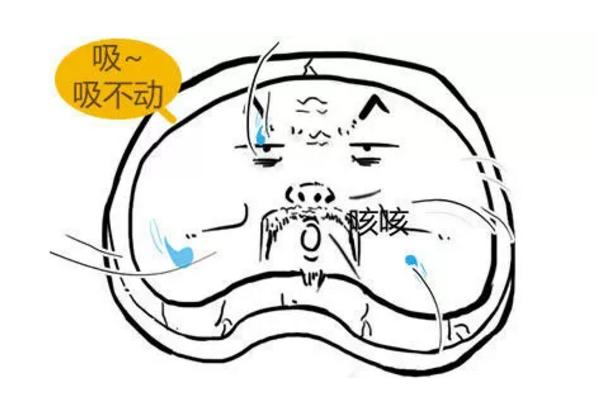 此文章让你彻底明白什么是：腰间盘突出