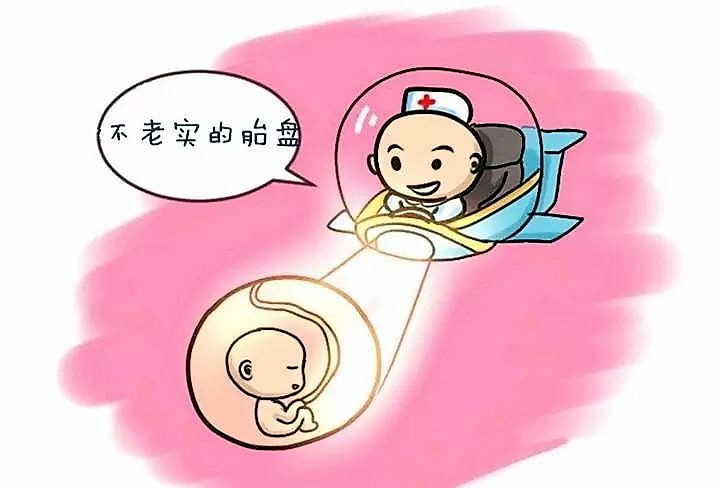 辟谣！胎盘低可不一定是前置胎盘，别吓唬自己