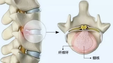 站姿哑铃练背肌最好的8个动作,练习哑铃的正确姿势家常做法