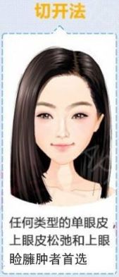 割完双眼皮不忌嘴会怎样,全切双眼皮疤痕增生期是什么时候