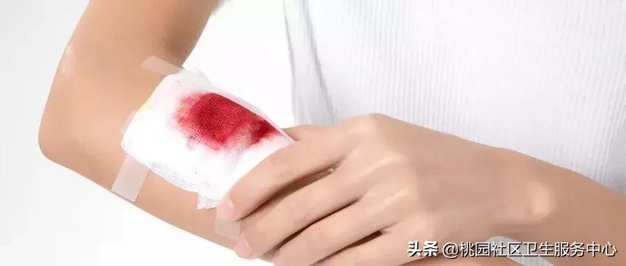 手被不锈钢划伤要打破伤风吗,手指被刀划伤了要不要打破伤风针