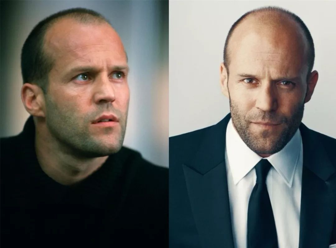 威廉王子秃顶了哈里为啥没秃顶,威廉王子为什么喜欢秃顶