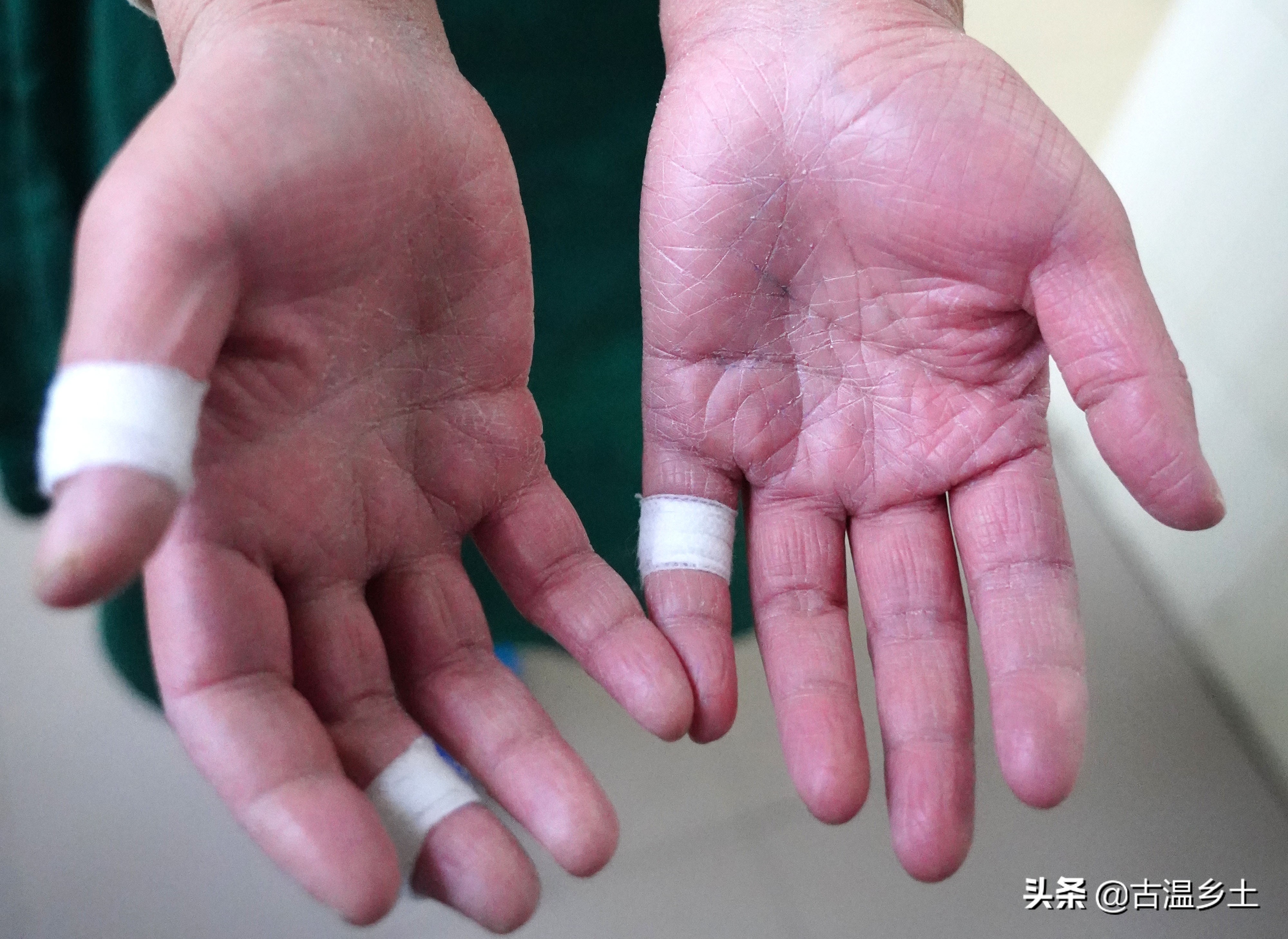 暖心战疫致敬一线,战疫一线的日夜坚守