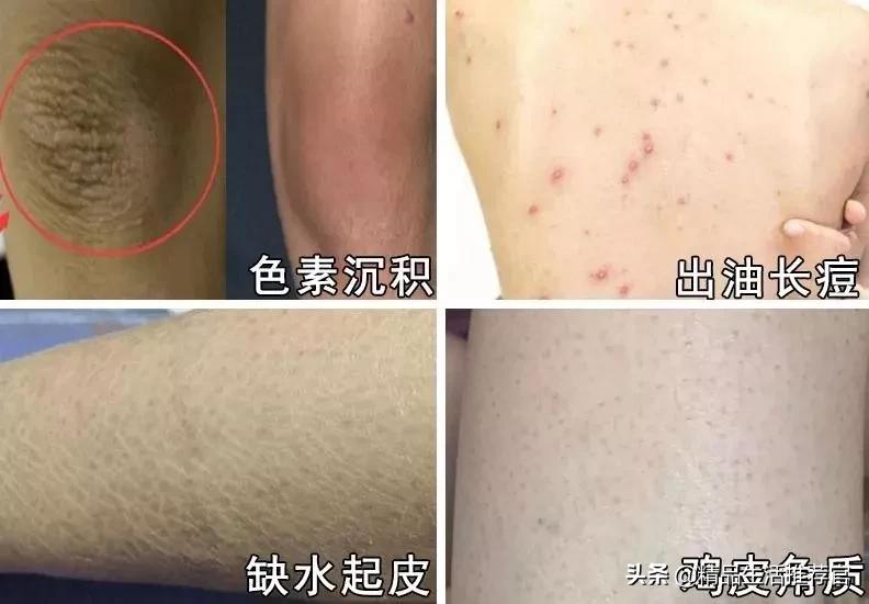 搓澡巾搓得舒服又干净,搓澡巾能把身上洗得多干净