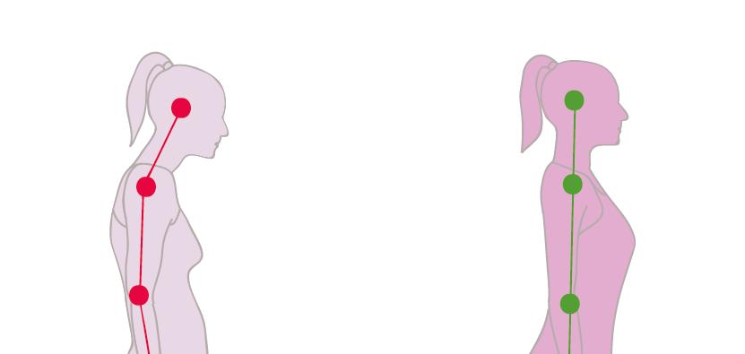 含胸驼背脖子前倾如何改善正骨,脖子前倾驼背最快纠正法