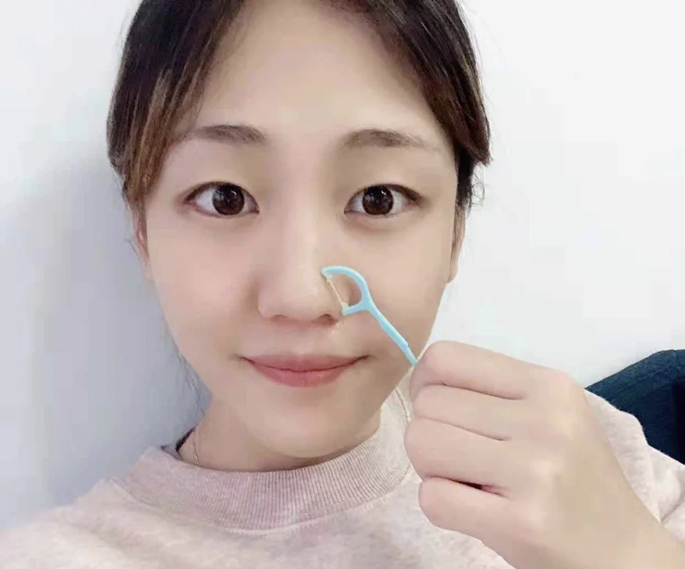 黑头怎么去除立竿见影,刮鼻子去黑头容易得酒糟鼻吗